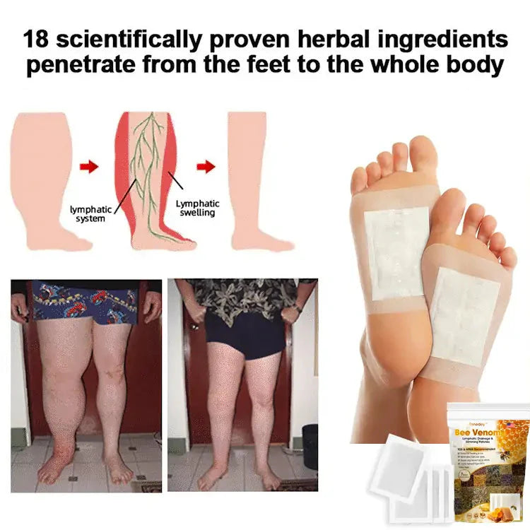 Bee Venom Lymphatic Damage & Sliming Patches 🌿👣(10 Patches) BUY 10 GET 10 FREE